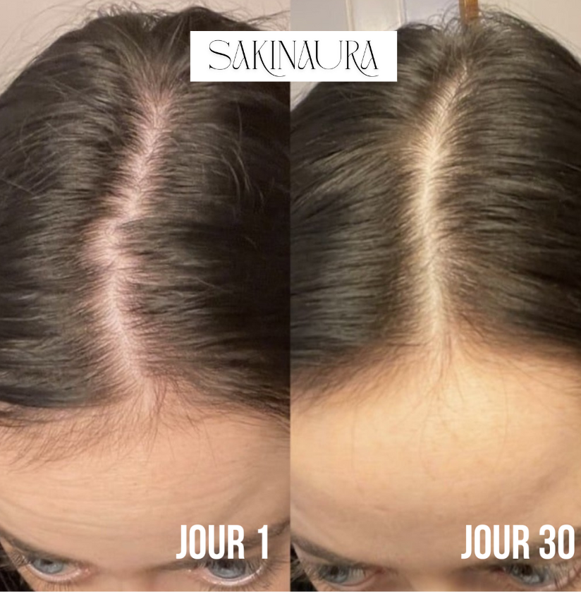 Sakina HairPro - Brosse massante anti-chute et pousse rapide