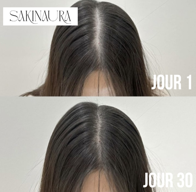 Sakina HairPro - Brosse massante anti-chute et pousse rapide