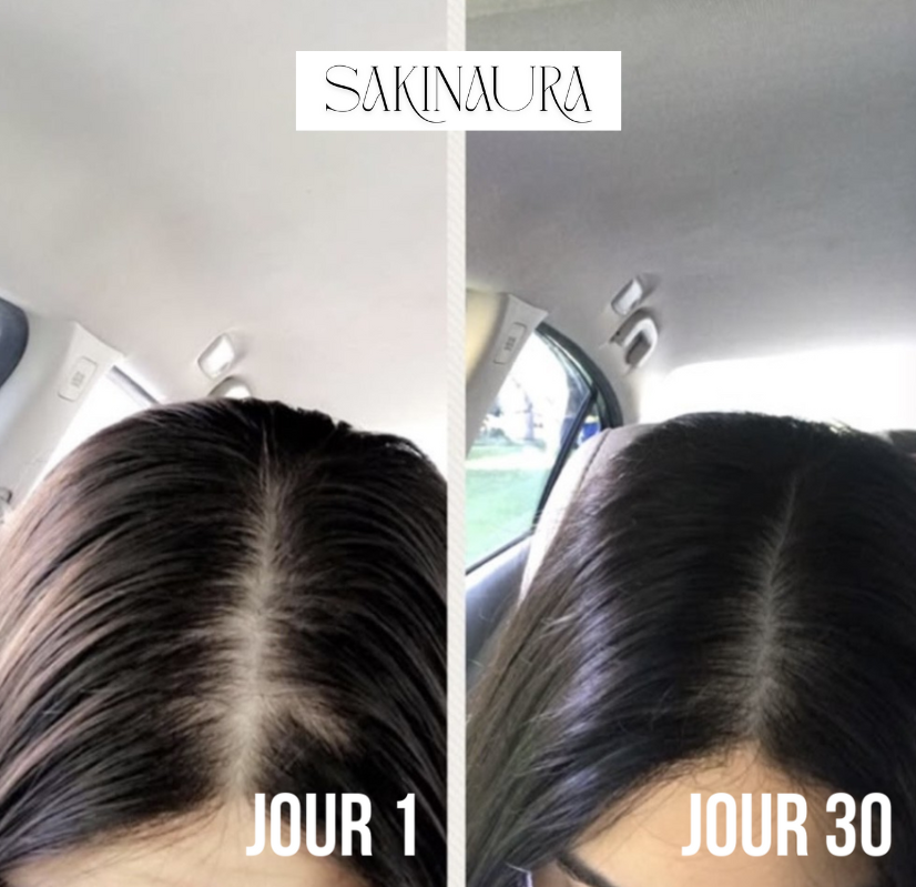 Sakina HairPro - Brosse massante anti-chute et pousse rapide