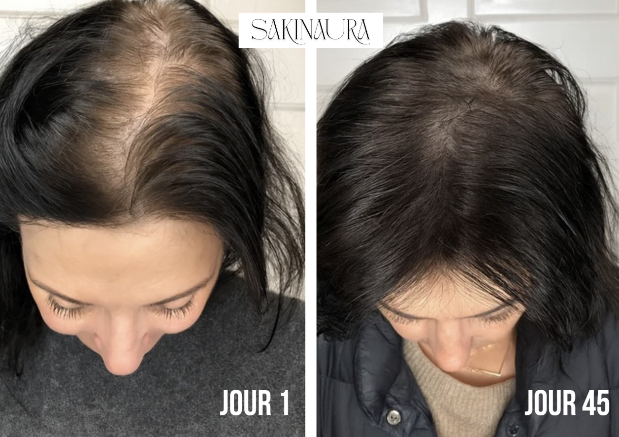 Sakina HairPro - Brosse massante anti-chute et pousse rapide